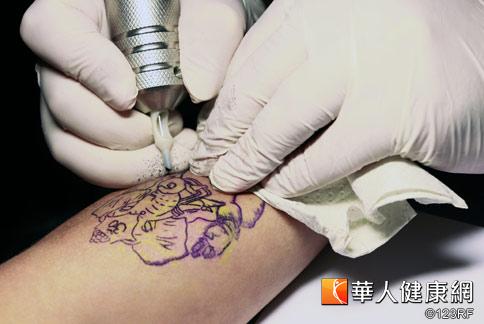 刺青先三思 异位性皮肤炎别尝试
