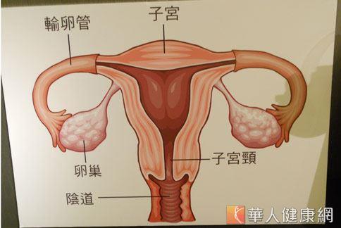 剖腹产造成的子宫壁疤痕可能让月经经血滞留,千万不可小觑.