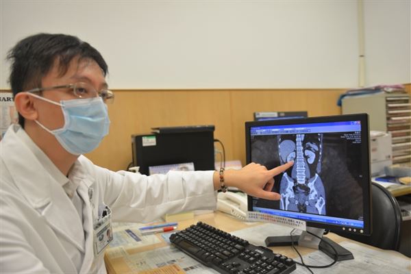 台北慈院泌尿科林佳達醫師提醒民眾，無痛性血尿恐是尿路腫瘤引起，不可輕忽。（圖片／台北慈濟醫院提供）