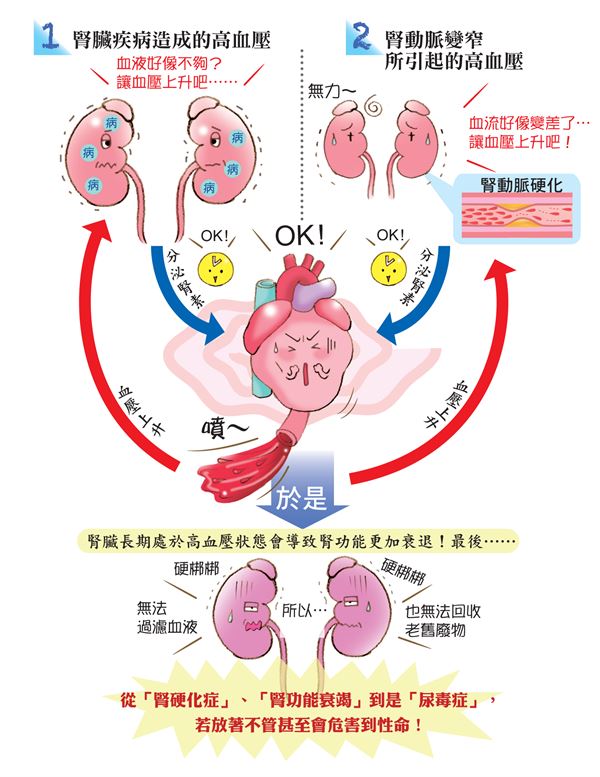 别小看高血压!轻忽恐造成肾功能衰退