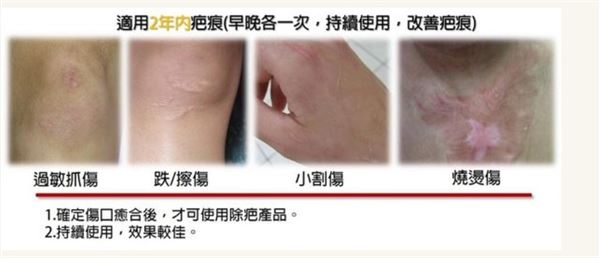 (圖片提供/微笑藥師藥師網提供)