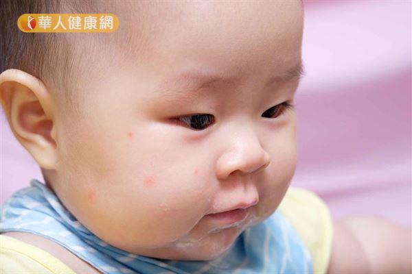 為什麼相較大人,蚊子偏愛叮咬寶寶呢?這是因為蚊子會靠著人體散發的溫度來定位。而孩童、幼兒的新陳代謝速率較成人佳,體溫相對較高,所以特別容易吸引蚊子駐足。