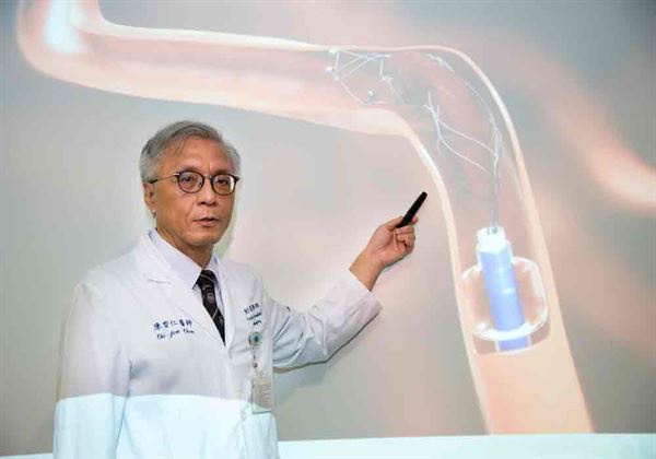 陳啟仁醫師(如圖)透過機械式動脈取栓術將病人腦中的血栓取出。(圖片提供／雙和醫院)