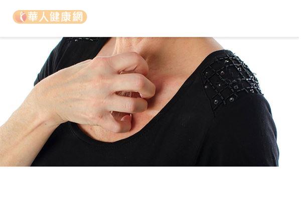 皮膚過敏患者日常飲食應以清淡為主,少接觸容易造成過敏的食物,像酒類、海鮮以及辛辣刺激食物,並多補充新鮮蔬菜或水果。