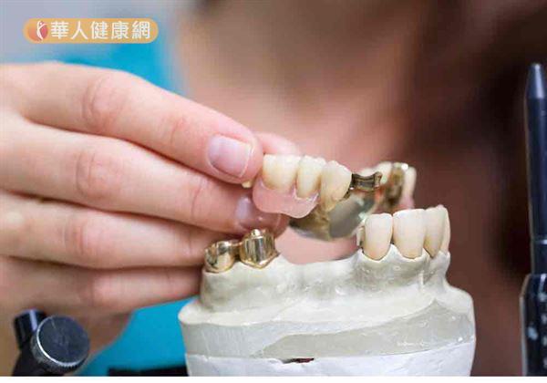 齒顎矯正不分性別，首先會做完整的口腔狀況評估。