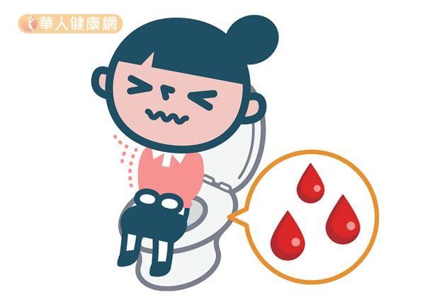有腸躁症或是便祕等問題,也要從改善飲食習慣著手。