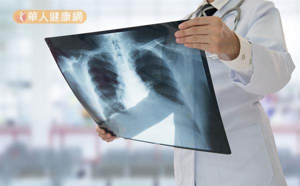 若咳嗽伴隨發燒，就一定要做胸部X光檢查，X光檢查可檢查出腫瘤、肺結核、肺膿瘍和各種原因的肺炎。