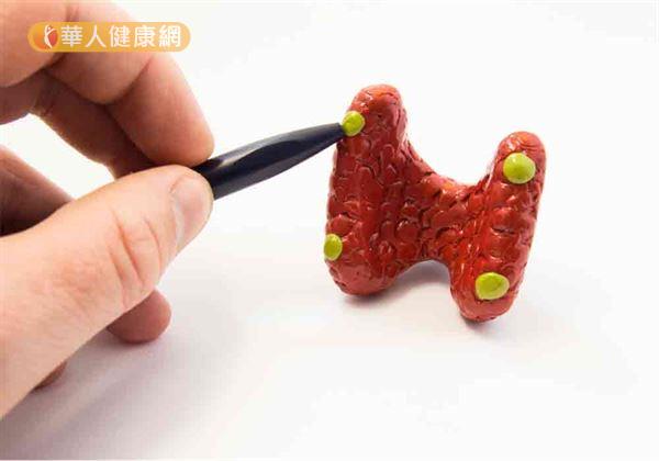 任何年紀都有可能出現副甲狀線機能亢進的問題,但又以50歲以上最為常見,其中女性約為男性2倍,且隨著年齡增長而增加機率。