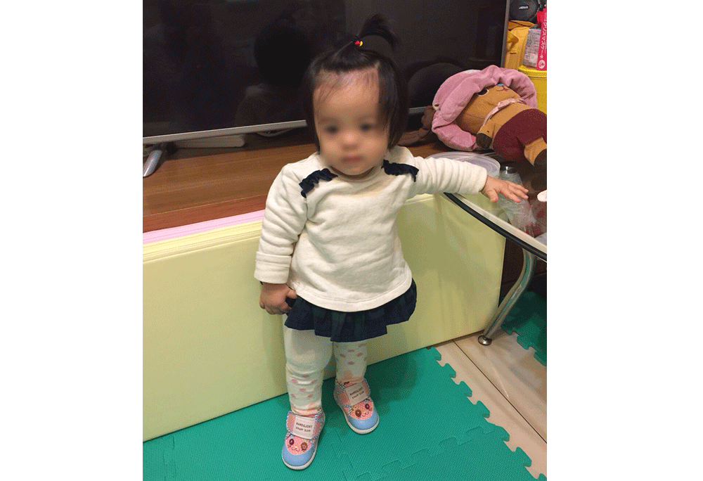 巴掌仙子娜娜已經1歲大了。(圖片提供/國泰醫院)