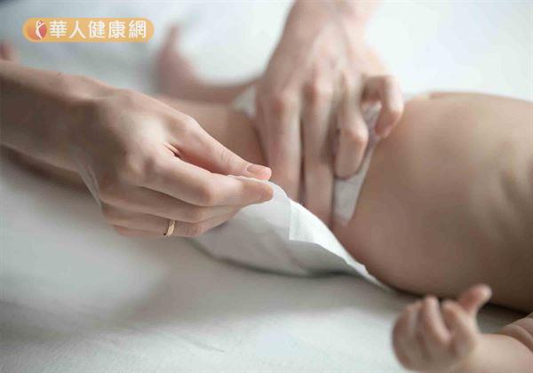 由於脂漏性皮膚炎不只成人會發生,就連嬰幼兒也可能罹患。因此,在用藥的選擇上,更要特別當心!