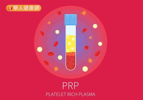 目前臨床上根據血小板血漿分離方式的不同,PRP又可分為進階型(Pure PRP)及傳統型 (L-PRP)2種。