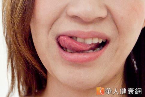 许多人认为舌头麻是中风的前兆,那可不一定,医师表示舌头麻大多是口腔