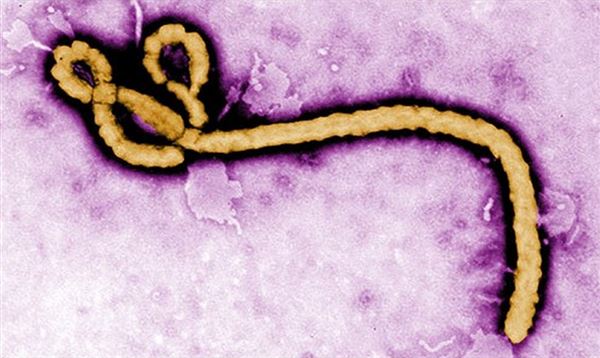 感染伊波拉病毒的致命率高達7成，目前沒有疫苗和藥物可預防和治療。（圖片／取材自美國CDC官網）
