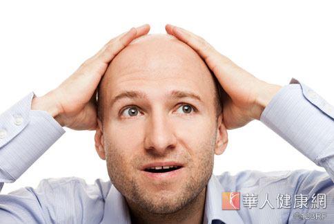 由於飲食及生活習慣的緣故，不少人從30多歲就開始出現禿頭。