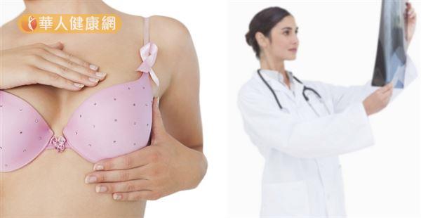網路謠傳做乳房X光檢查會增加甲狀腺癌的風險，但國健署查證研究駁斥謠言。
