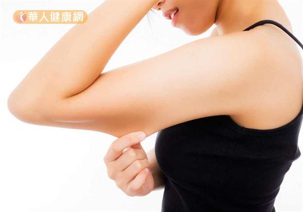 導致女性上臂看來肥胖的主因，多與日常生活中較少使用到手臂上緣肌肉，缺乏鍛鍊導致脂肪堆積、肌膚鬆弛有關。
