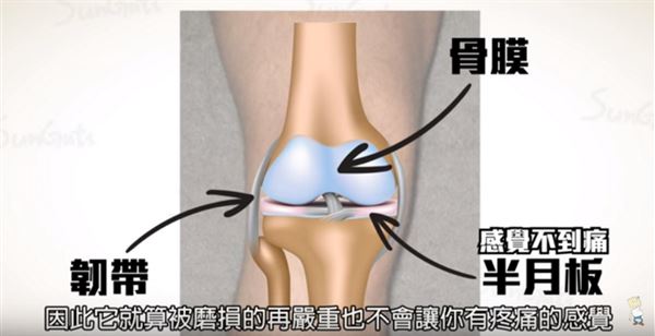 膝盖痛≠关节退化 深蹲动作强化膝关节 | 复健治