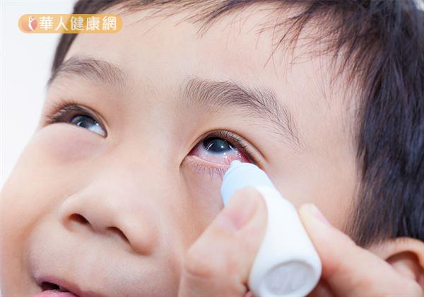 網路卻謠傳，長期點散瞳劑易增加白內障罹患風險，使不少父母不敢給孩子使用。但是，散瞳劑真有這麼可怕嗎？