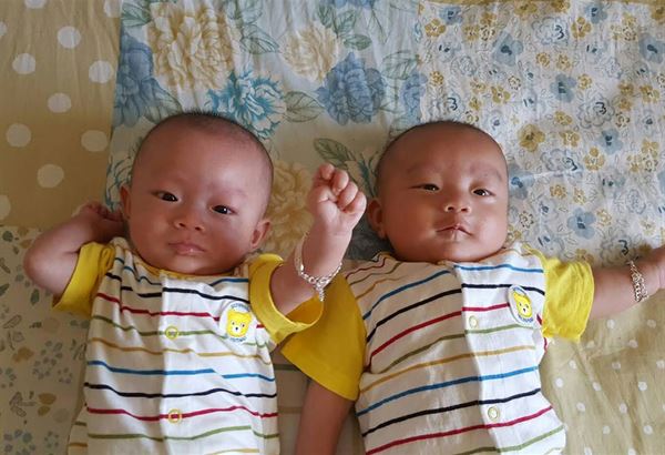 「減胎手術」，將三胞胎減為雙胞胎。最後雙胞胎順利於36週接受剖腹生產，健康活潑成長。（圖片提供／林口長庚紀念醫院婦產部蕭勝文醫師）