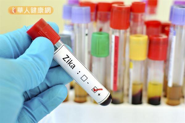 國內出現第4例境外移入的茲卡病毒個案，這同時也是第一個感染感染茲卡病毒的台灣人。