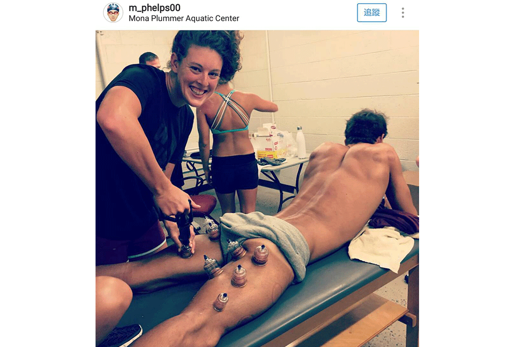 奧運游泳金牌選手美國31歲的「飛魚」菲比斯，對於東方傳統療法「拔罐」情有獨鍾。（圖片／翻攝自Michael Phelps Instagram)