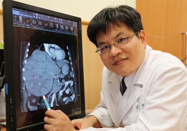 台中慈濟醫院一般外科余政展主任表示，在影像檢查下發現，羅先生的肝臟竟長出23公分超大「霸王級」肝癌腫瘤。（圖片／台中慈濟醫院提供）