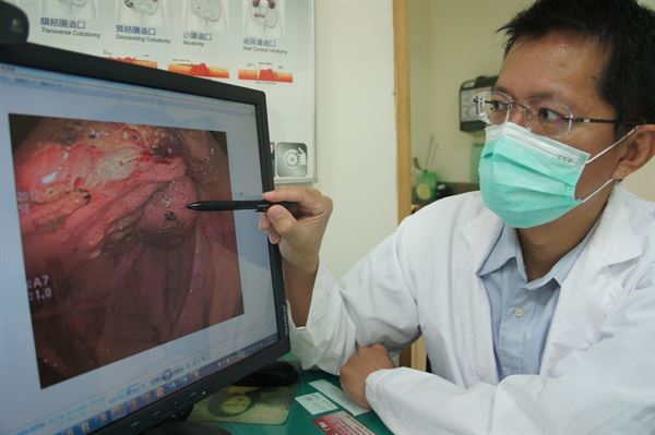 吳喬森醫師說明吳阿嬤是嚴重出血型的大腸癌個案，到院時血紅素僅5.5 g/dL。（圖片提供／光田醫院）