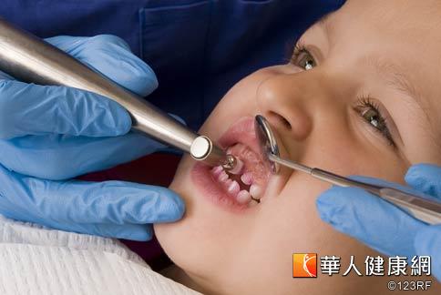 北市提供1200名儿童免费涂氟